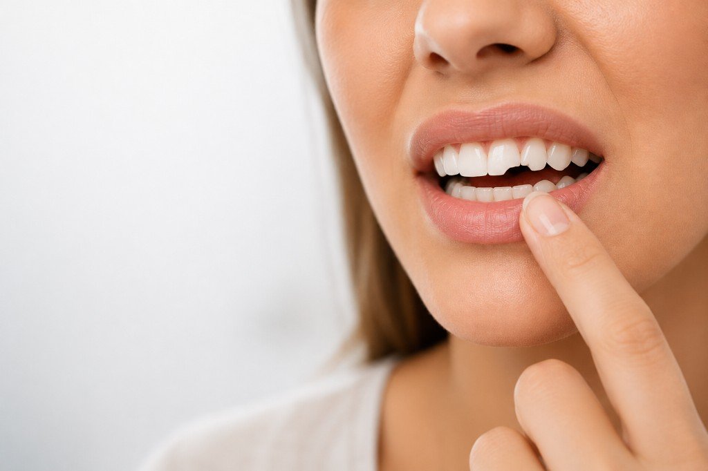 A close-up of a person touching their front teeth after a dental injury