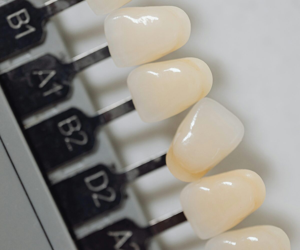 A dental shade guide used to match the colour of a restoration to natural teeth