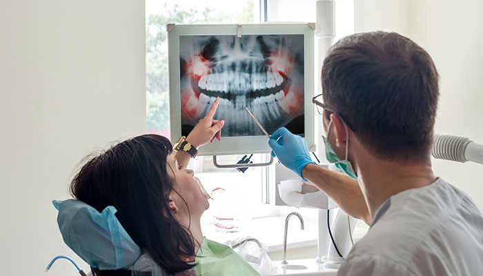 Oral surgery procedure, tooth extraction being performed